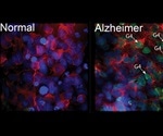 New function of BMI1 gene can protect against Alzheimer’s disease