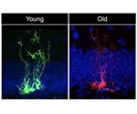 Study shows that neural stem cells age quickly