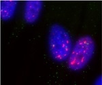 Tumor-inhibiting protein p53 boosts gene expression by bringing together nuclear speckles and DNA