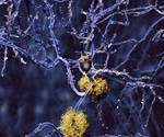 Genetic Testing in the fight against Alzheimer’s