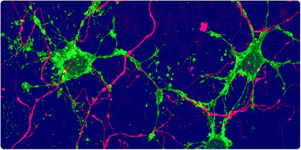 New types of glial cells in the brain may treat neurodegenerative diseases