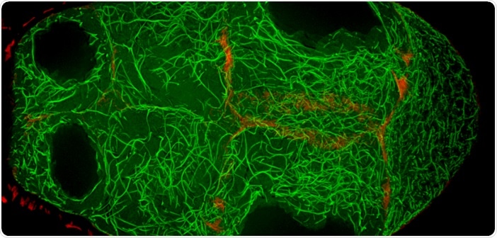Newly identified protein regulates the flow of materials in the Drosophila ovary