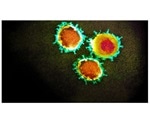 Study reveals SARS-CoV-2 variant is less sensitive to inhibition by antibodies
