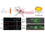 Bacteria-derived curli amyloid fibril promotes neurodegeneration in the host