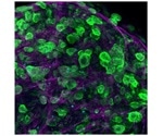 Scientists create a three-dimensional pancreatic cancer tumor model