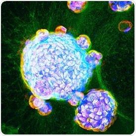 Scientists develop lung organoids to imitate actual SARS-CoV-2 infection