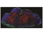 Novel T cells reside in lymph nodes and offer protection against melanoma