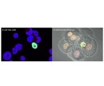 Researchers discover new stem cell population that closely matches existing human stem cells
