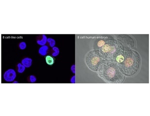 Researchers discover new stem cell population that closely matches existing human stem cells