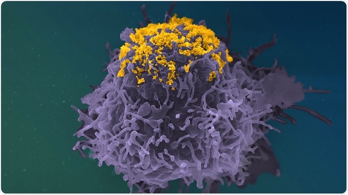 Novel function of anti-HIV-1 antibodies discovered using robust microscopy techniques