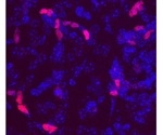 Research shows DLX2 protein regenerate astrocytes into neural stem-like cells