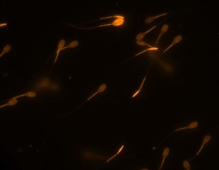 Researchers demonstrate how sperms defend their membranes from oxidation