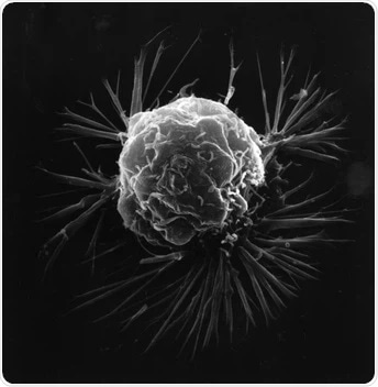 Study shows that mechanical stress help cancer cells metastasize