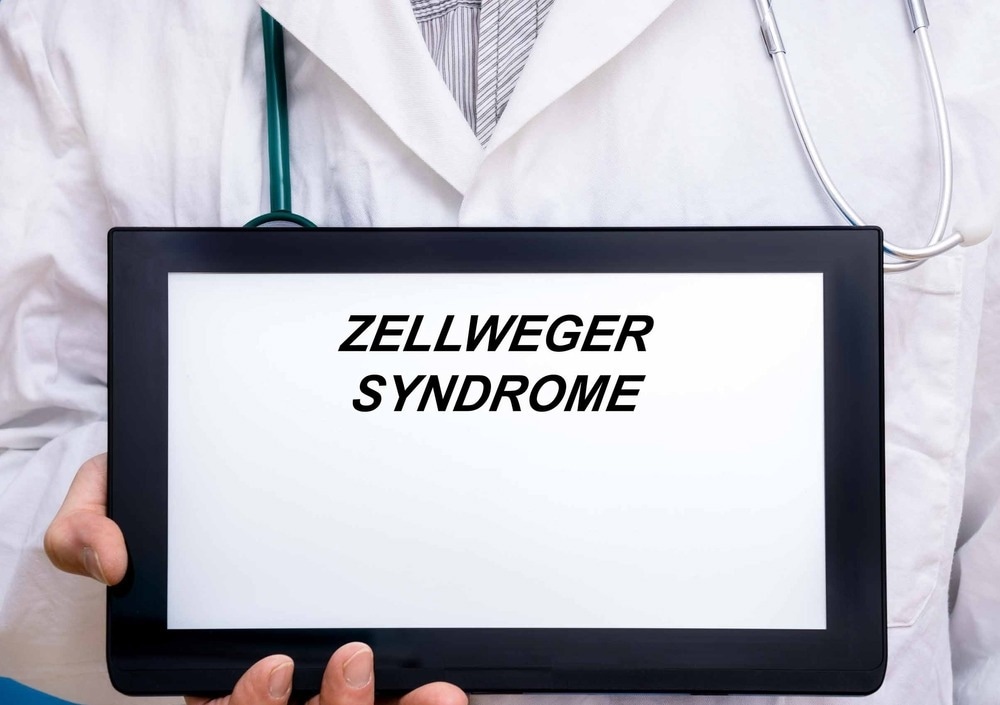 Zellweger syndrome