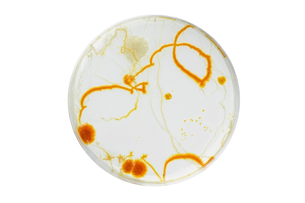 Cells in Petri Dish