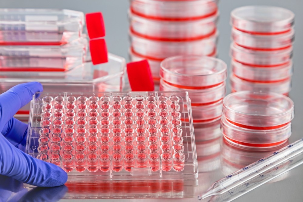 What Is a Representative Cell Culture?