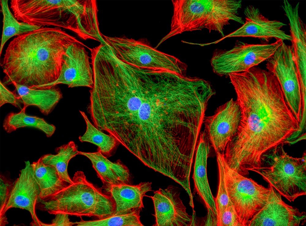 Bovine Pulmonary Artery Endothelial Cells (BPAE) stained for mitochondria, phalloidin, and nuclei.