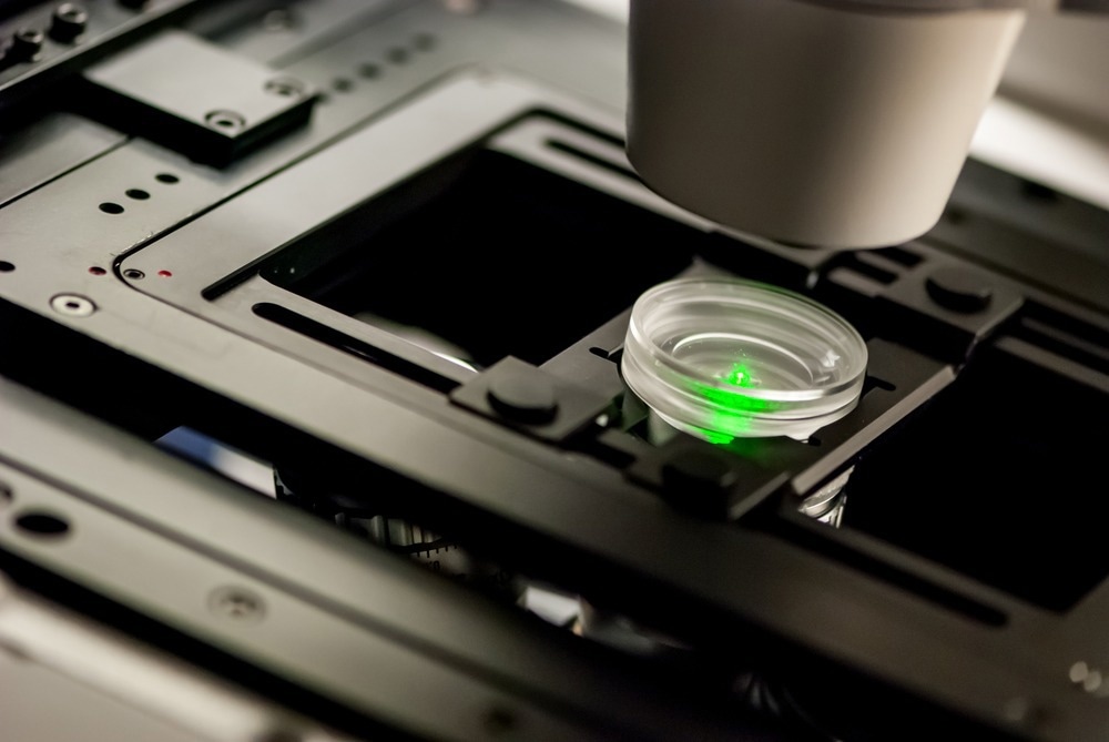 Biological sample observed on a confocal laser scanning fluorescence microscope
