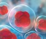 Treating Disease Using Your Own Stem Cells