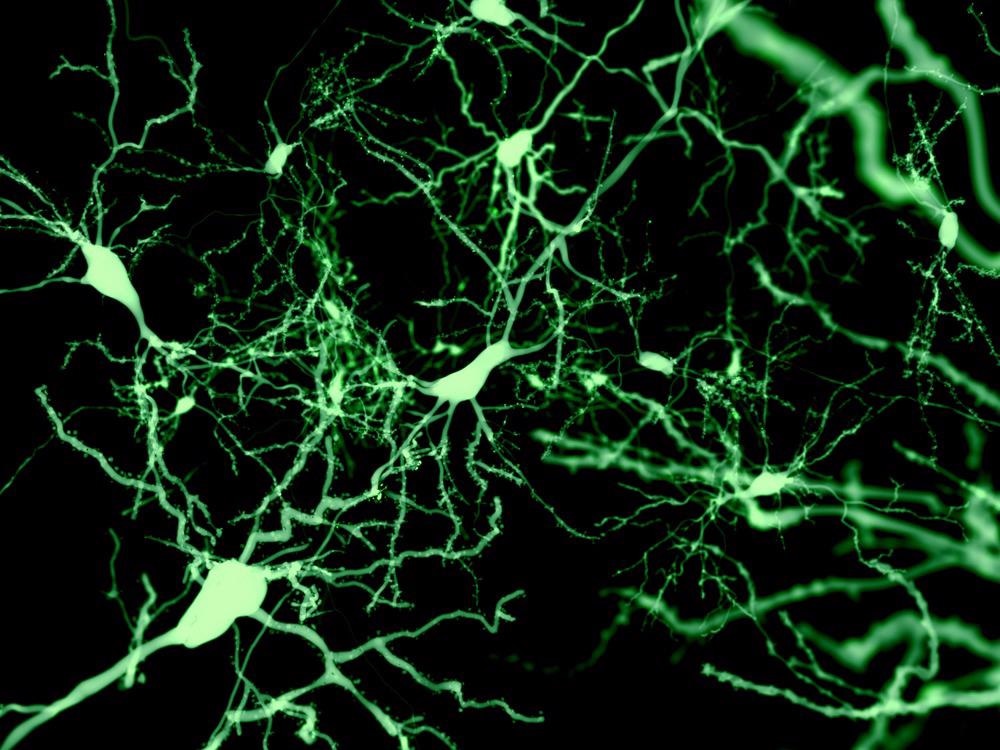 Neurons under fluorescence