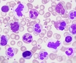What are Hematopoietic Immune Cells?
