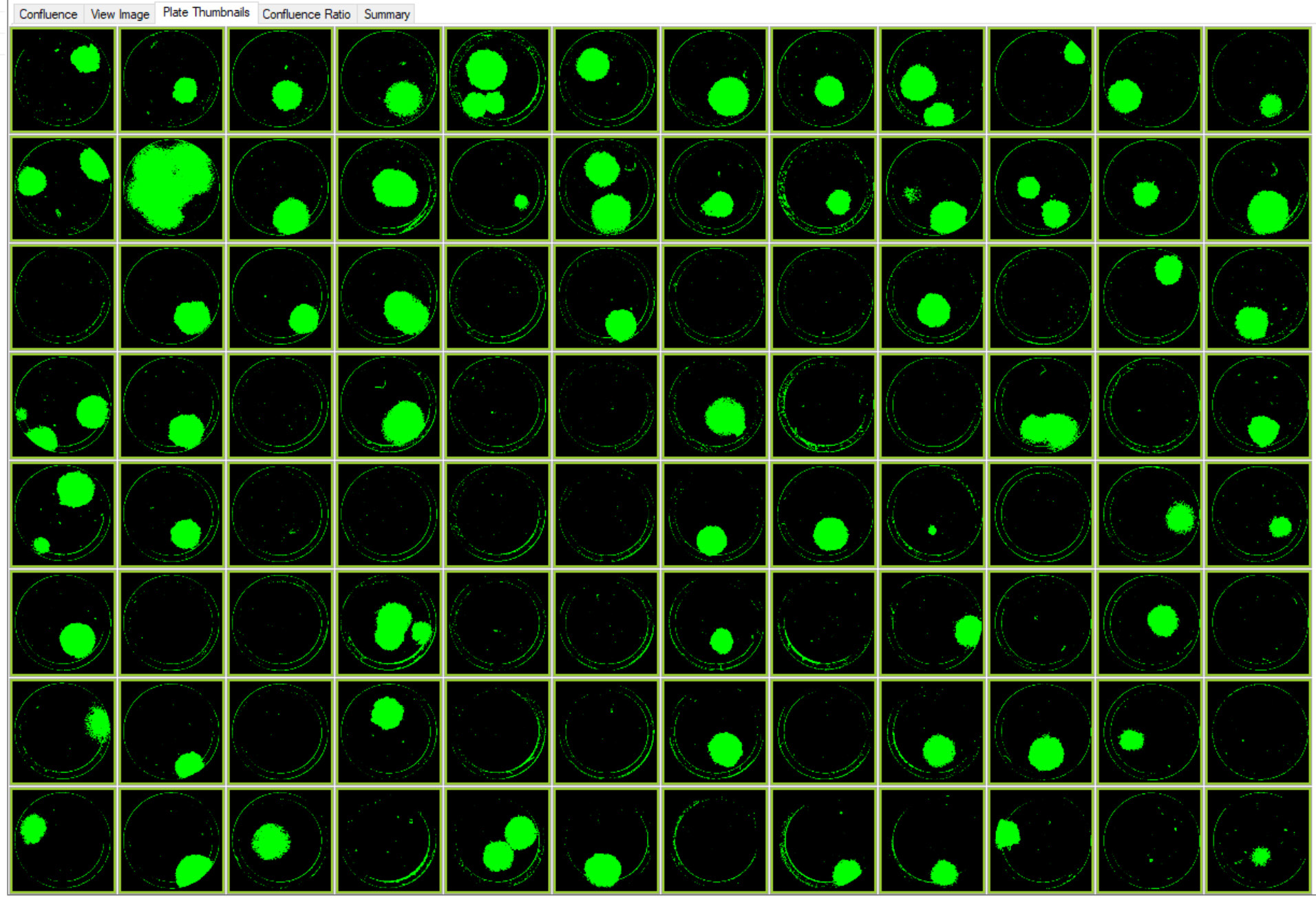 Images of colonies of single-cell printed CRISPR edited cells with RFP marker. This plate layout image of a 96–well Costar 3300 plate with cells on Day 9 was acquired using CSI-FL at 4X