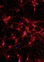 ioGlutamatergic Neurons MAPT N279K/WT™