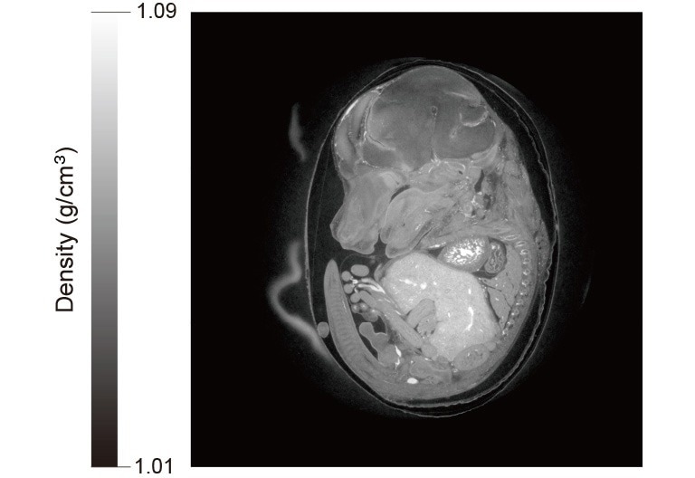 X-Ray phase contrast CT image of mouse embryo. X-Ray phase contrast CT image of mouse embryo from ORCA-Quest combined with High resolution X-Ray imaging system (M11427). Exposure time: 15 milliseconds, Total measurement time: 6.5 minutes.