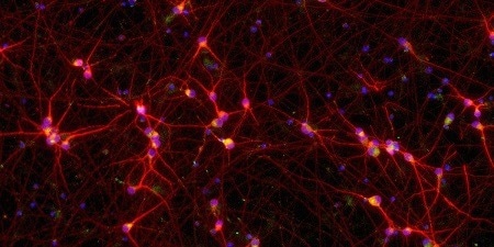 ioGlutamatergic Neurons TDP-43 M337V™