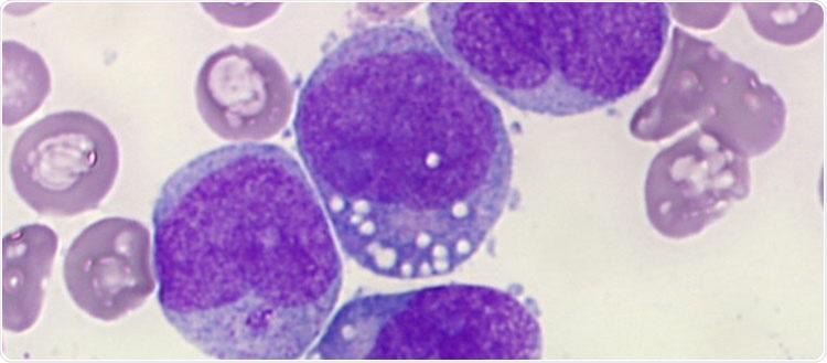 Experts trigger apoptosis in leukemia cells by disrupting their energy maintenance mechanism