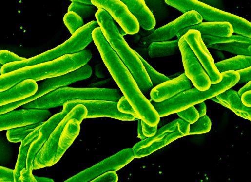 Tuberculosis causes early epigenetic aging in cells, study finds