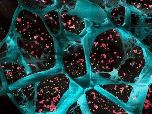 Study shows how biodegradable gel helps immune system to keep cancer away