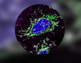 Researchers discover a mechanism by which the protein DELE1 detects organelle stress