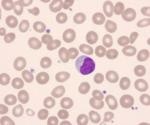 Researchers analyze the body’s immune cells with blood cancer cells