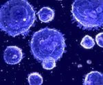 Immune cell migration contributes to inefficient antitumor immunity, study finds