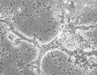 Scientists identify a new soil amoeba species in Chernevaya taiga