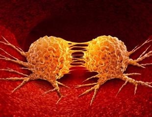 Study reveals advance in cell biology may lead to effective cancer therapy technique