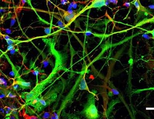 Researchers analyze the effect of dopamine on gene activity and addiction