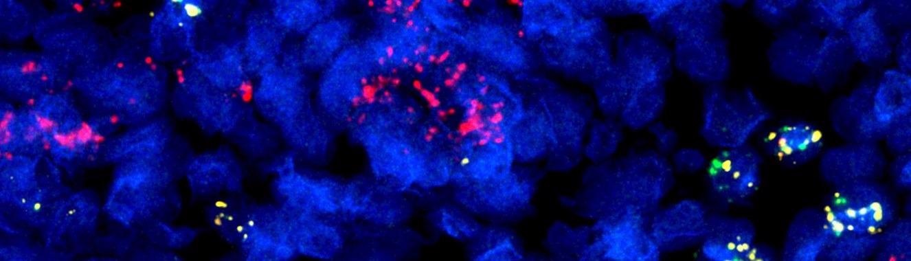 Researchers create Open-access atlases of human immune cells in adults
