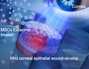 Researchers create human cornea-on-a-chip to check the therapeutic effect of MSC exosomes on corneal disorders