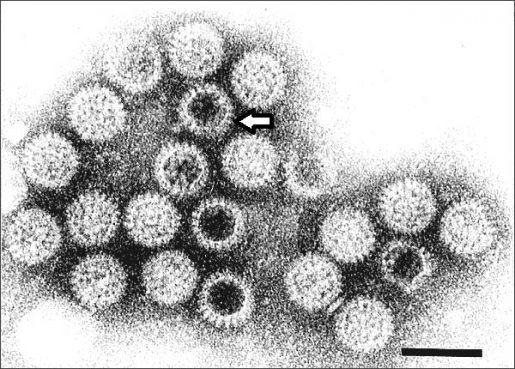 Researchers utilize AI to reveal hitherto unknown 3D structures in rotavirus spike protein