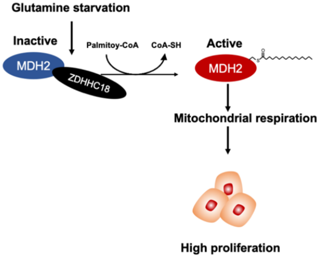 ZDHHC18-mediated MDH2 palmitoylation upholds mitochondrial respiration and boosts ovarian cancer malignancy