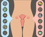 Probiotics do not enhance unhealthy vaginal health, recent study shows