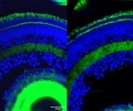 Researchers discover the gene essential for the growth of photoreceptors
