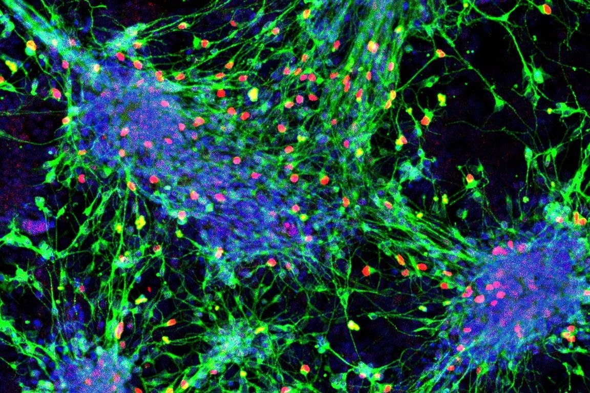 Research outlines how stem cells become sensory interneurons