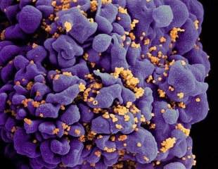 HIV latent cells produce a possible cure investigation