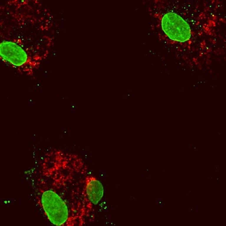 Mitochondrial DNA plays a crucial role in inflammation, study finds