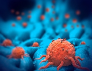 Genetic mapping helps to analyze how cancer cells grow