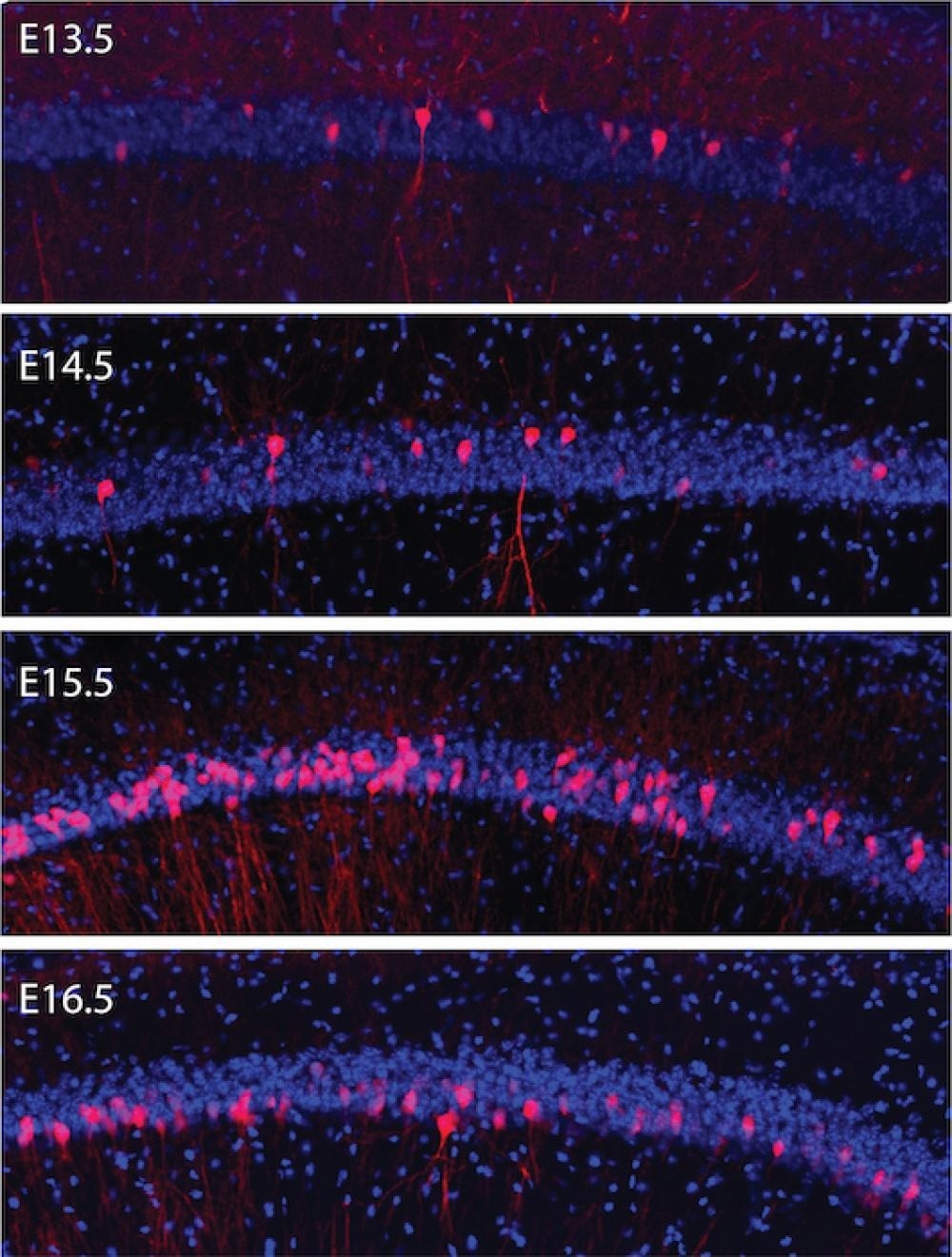 Brain cells with the same birthdate display distinct connectivity