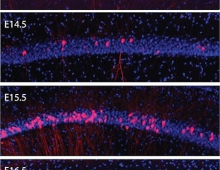 Brain cells with the same birthdate display distinct connectivity